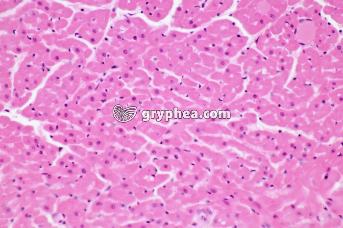 Mucle cardiaque CT x100 - gryphea.com